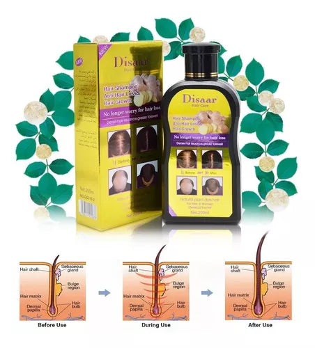 🌿 SHAMPOO ANTICAÍDA PRO DE JENGIBRE – FUERZA Y CRECIMIENTO DESDE LA RAÍZ