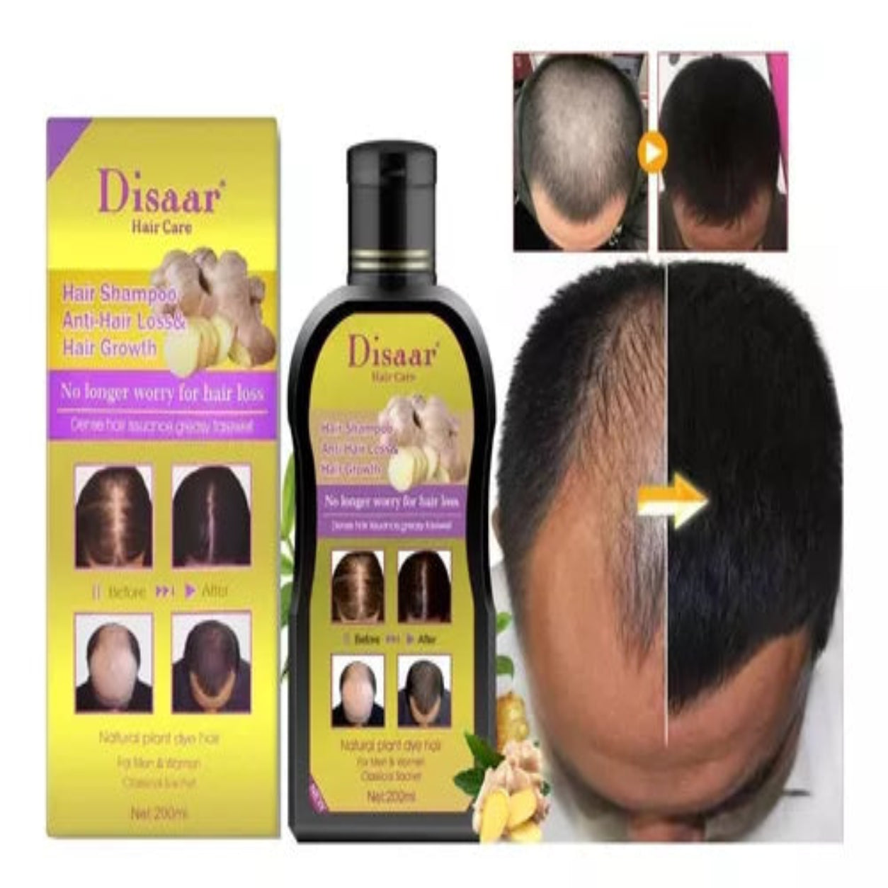 🌿 SHAMPOO ANTICAÍDA PRO DE JENGIBRE – FUERZA Y CRECIMIENTO DESDE LA RAÍZ