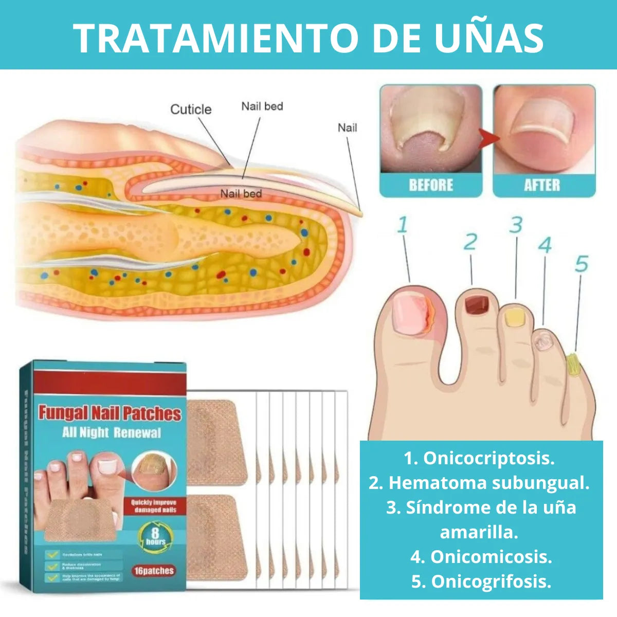 PARCHE UÑAS ANTIHONGOS x16 2x1