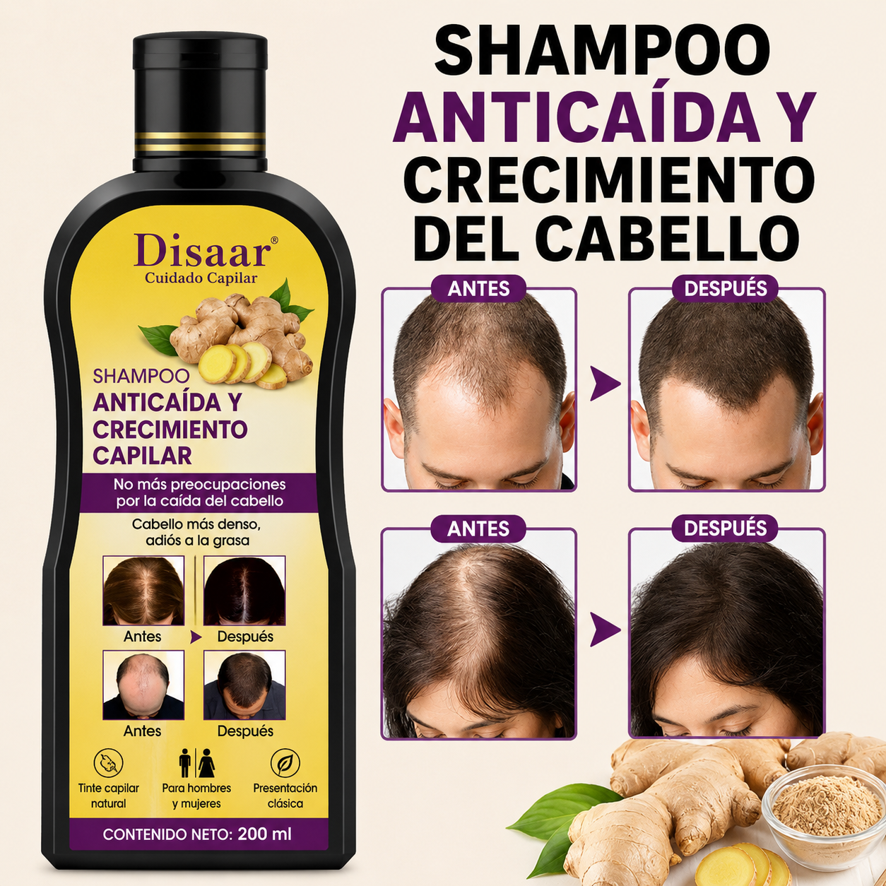 🌿 SHAMPOO ANTICAÍDA PRO DE JENGIBRE – FUERZA Y CRECIMIENTO DESDE LA RAÍZ